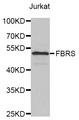 FBS1 Antibody - Western blot analysis of extracts of various cell lines.