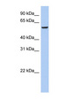 FBX33 / FBXO33 Antibody - FBXO33 antibody Western blot of Fetal Liver lysate. This image was taken for the unconjugated form of this product. Other forms have not been tested.
