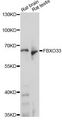 FBX33 / FBXO33 Antibody - Western blot analysis of extracts of various cell lines, using FBXO33 antibody at 1:1000 dilution. The secondary antibody used was an HRP Goat Anti-Rabbit IgG (H+L) at 1:10000 dilution. Lysates were loaded 25ug per lane and 3% nonfat dry milk in TBST was used for blocking. An ECL Kit was used for detection and the exposure time was 20s.