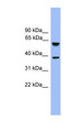 FBXL12 Antibody - FBXL12 antibody Western blot of Fetal Heart lysate. This image was taken for the unconjugated form of this product. Other forms have not been tested.