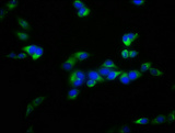 FBXL2 Antibody - Immunofluorescence staining of Hela cells with FBXL2 Antibody at 1:100, counter-stained with DAPI. The cells were fixed in 4% formaldehyde, permeabilized using 0.2% Triton X-100 and blocked in 10% normal Goat Serum. The cells were then incubated with the antibody overnight at 4°C. The secondary antibody was Alexa Fluor 488-congugated AffiniPure Goat Anti-Rabbit IgG(H+L).