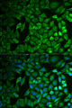 FBXO11 Antibody - Immunofluorescence analysis of MCF-7 cells.