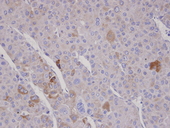 FBXO2 Antibody - IHC of paraffin-embedded Adrenal gland tumor using FBXO2 antibody at 1:100 dilution.