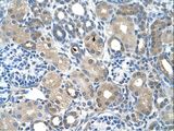 FBXO25 Antibody - FBXO25 antibody ARP43118_T100-EAW51453-FBXO25(F-box protein 25) Antibody was used in IHC to stain formalin-fixed, paraffin-embedded human kidney.  This image was taken for the unconjugated form of this product. Other forms have not been tested.