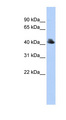 FBXO4 / FBX4 Antibody - FBXO4 antibody Western blot of 293T cell lysate. This image was taken for the unconjugated form of this product. Other forms have not been tested.