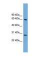 FBXW8 Antibody - FBXW8 antibody Western blot of ACHN lysate. This image was taken for the unconjugated form of this product. Other forms have not been tested.