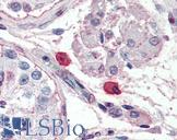 FceR1 / Fc Epsilon Receptor 1 Antibody - Anti-FceR1 / Fc Epsilon Receptor 1 antibody IHC of human mast cells. Immunohistochemistry of formalin-fixed, paraffin-embedded tissue after heat-induced antigen retrieval. Antibody concentration 10 ug/ml.  This image was taken for the unconjugated form of this product. Other forms have not been tested.