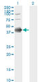 FCER2 / CD23 Antibody - Western Blot analysis of FCER2 expression in transfected 293T cell line by FCER2 monoclonal antibody (M03), clone S52.Lane 1: FCER2 transfected lysate(36.5 KDa).Lane 2: Non-transfected lysate.