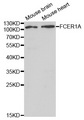 FcERI / Fc Epsilon RI Antibody - Western blot analysis of extracts of various cell lines, using FCER1A antibody at 1:1000 dilution. The secondary antibody used was an HRP Goat Anti-Rabbit IgG (H+L) at 1:10000 dilution. Lysates were loaded 25ug per lane and 3% nonfat dry milk in TBST was used for blocking.