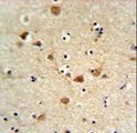 FCGR1A / CD64 Antibody - FCGR1A Antibody IHC of formalin-fixed and paraffin-embedded brain tissue followed by peroxidase-conjugated secondary antibody and DAB staining.