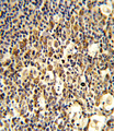 FCGR1B Antibody - Formalin-fixed and paraffin-embedded human tonsil reacted with FCGR1B Antibody , which was peroxidase-conjugated to the secondary antibody, followed by DAB staining. This data demonstrates the use of this antibody for immunohistochemistry; clinical relevance has not been evaluated.