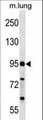 FCHO2 Antibody - FCHO2 Antibody western blot of mouse lung tissue lysates (35 ug/lane). The FCHO2 antibody detected the FCHO2 protein (arrow).
