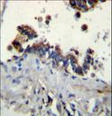 FCN3 / Ficolin-3 Antibody - FCN3 Antibody immunohistochemistry of formalin-fixed and paraffin-embedded human lung tissue followed by peroxidase-conjugated secondary antibody and DAB staining.