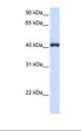 FCRLA Antibody - Hela cell lysate. Antibody concentration: 1.0 ug/ml. Gel concentration: 12%.  This image was taken for the unconjugated form of this product. Other forms have not been tested.