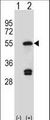 FDFT1 / Squalene Synthase Antibody - Western blot of FDFT1 (arrow) using rabbit polyclonal FDFT1 Antibody. 293 cell lysates (2 ug/lane) either nontransfected (Lane 1) or transiently transfected (Lane 2) with the FDFT1 gene.