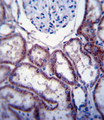 FER Antibody - FER Antibody immunohistochemistry of formalin-fixed and paraffin-embedded human kidney tissue followed by peroxidase-conjugated secondary antibody and DAB staining.