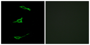 FFAR1 / GPR40 Antibody - Immunofluorescence analysis of LOVO cells, using FFAR1 Antibody. The picture on the right is blocked with the synthesized peptide.