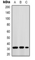 FFAR1 / GPR40 Antibody - Western blot analysis of GPR40 expression in K562 (A); mouse kidney (B); COS7 (C) whole cell lysates.