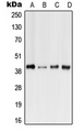 FFAR3 / GPR41 Antibody - Western blot analysis of GPR41 expression in HeLa (A); Raw264.7 (B); H9C2 (C); rat Liver (D) whole cell lysates.