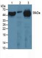 FGB / Fibrinogen Beta Chain Antibody - Western Blot; Sample: Lane1: Human Serum; Lane2: Human Liver Tissue; Lane3: Mouse Heart Tissue.