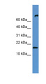 FGF1 / Acidic FGF Antibody - FGF1 antibody Western blot of Mouse Heart lysate. This image was taken for the unconjugated form of this product. Other forms have not been tested.
