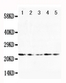 FGF10 Antibody - Anti-FGF10 antibody, Western blotting Lane 1: U87 Cell LysateLane 2: HELA Cell LysateLane 3: A519 Cell LysateLane 4: 293T Cell LysateLane 5: HELA Cell Lysate