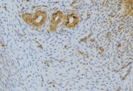 FGF10 Antibody - 1:100 staining human uterus tissue by IHC-P. The sample was formaldehyde fixed and a heat mediated antigen retrieval step in citrate buffer was performed. The sample was then blocked and incubated with the antibody for 1.5 hours at 22°C. An HRP conjugated goat anti-rabbit antibody was used as the secondary.