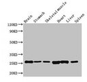 Fgf15 Antibody - Western Blot Positive WB detected in: Mouse brain tissue, Mouse stomach tissue, Mouse skeletal muscle tissue, Rat heart tissue, Rat liver tissue, Rat spleen tissue All lanes: Fgf15 antibody at 3.5µg/ml Secondary Goat polyclonal to rabbit IgG at 1/50000 dilution Predicted band size: 26 kDa Observed band size: 26 kDa