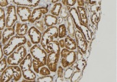 FGF16 Antibody - 1:100 staining mouse kidney tissue by IHC-P. The sample was formaldehyde fixed and a heat mediated antigen retrieval step in citrate buffer was performed. The sample was then blocked and incubated with the antibody for 1.5 hours at 22°C. An HRP conjugated goat anti-rabbit antibody was used as the secondary.