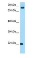 FGF18 Antibody - FGF18 antibody Western Blot of ACHN.  This image was taken for the unconjugated form of this product. Other forms have not been tested.