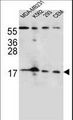 FGF22 Antibody - FGF22 Antibody western blot of MDA-MB231,K562,293,CEM cell line lysates (35 ug/lane). The FGF22 antibody detected the FGF22 protein (arrow).