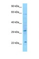 FGF8 Antibody - FGF8 antibody Western blot of HeLa Cell lysate. Antibody concentration 1 ug/ml.  This image was taken for the unconjugated form of this product. Other forms have not been tested.