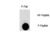 FGFR1 / FGF Receptor 1 Antibody - Dot blot of Phospho-FGFR1-Y307 polyclonal antibody on nitrocellulose membrane. 50ng of Phospho-peptide or Non Phospho-peptide per dot were adsorbed. Antibody working concentration was 0.5ug per ml. P-antibody: phospho-antibody; P-Peptide: phospho-peptide; NP-Peptide: non-phospho-peptide.