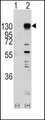 FGFR1 / FGF Receptor 1 Antibody - Western blot of FGFR1 (arrow) using rabbit polyclonal FGFR1 Antibody (Y653) (RB11303). 293 cell lysates (2 ug/lane) either nontransfected (Lane 1) or transiently transfected with the FGFR1 gene (Lane 2) (Origene Technologies).