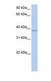 FGFR1OP / FOP Antibody - Fetal liver lysate. Antibody concentration: 1.0 ug/ml. Gel concentration: 12%.  This image was taken for the unconjugated form of this product. Other forms have not been tested.