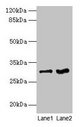 FGFR1OP2 Antibody - Western blot All lanes: FGFR1OP2 antibody at 6µg/ml Lane 1: Mouse gonadal tissue Lane 2: Human placenta tissue Secondary Goat polyclonal to rabbit IgG at 1/10000 dilution Predicted band size: 30, 25, 21 kDa Observed band size: 30 kDa