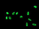FGFR2 / FGF Receptor 2 Antibody - Immunofluorescent staining of HeLa cells using anti-FGFR2 mouse monoclonal antibody.
