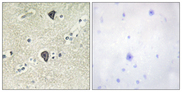 FGFR3 Antibody - Immunohistochemistry analysis of paraffin-embedded human brain tissue, using FGFR3 Antibody. The picture on the right is blocked with the synthesized peptide.