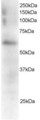 FGR Antibody - Antibody staining (0.5 ug/ml) of Mouse Spleen extracts (RIPA buffer, 35 ug total protein per lane). Primary incubated for 1 hour. Detected by Western blot of chemiluminescence.