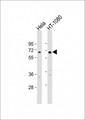 FIG1 / IL4I1 Antibody - All lanes: Anti-IL4I1 Antibody (C-Term) at 1:2000 dilution. Lane 1: HeLa whole cell lysate. Lane 2: HT-1080 whole cell lysate Lysates/proteins at 20 ug per lane. Secondary Goat Anti-Rabbit IgG, (H+L), Peroxidase conjugated at 1:10000 dilution. Predicted band size: 63 kDa. Blocking/Dilution buffer: 5% NFDM/TBST.