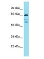 FIGNL2 Antibody - FIGNL2 antibody Western Blot of 721_B. Antibody dilution: 1 ug/ml.  This image was taken for the unconjugated form of this product. Other forms have not been tested.