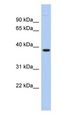 FITM1 Antibody - FITM1 antibody Western Blot of LOC161247 Antibody validated by WB using Fetal liver cell lysate at 0.2-1 ug/ml.  This image was taken for the unconjugated form of this product. Other forms have not been tested.