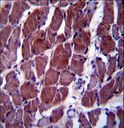 FIZ1 Antibody - FIZ1 Antibody immunohistochemistry of formalin-fixed and paraffin-embedded human skeletal muscle followed by peroxidase-conjugated secondary antibody and DAB staining.