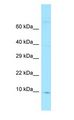 FKBP1A / FKBP12 Antibody - FKBP1A / FKBP12 antibody Western Blot of 721_B.  This image was taken for the unconjugated form of this product. Other forms have not been tested.