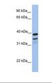 FKBP38 / FKBP8 Antibody - Fetal brain lysate. Antibody concentration: 1.0 ug/ml. Gel concentration: 12%.  This image was taken for the unconjugated form of this product. Other forms have not been tested.