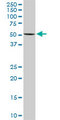 FKBP4 / FKBP52 Antibody - FKBP4 monoclonal antibody (M01), clone 5C11. Western blot of FKBP4 expression in Raw 264.7.