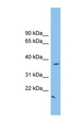 FKBPL Antibody - FKBPL antibody Western blot of U937 cell lysate. This image was taken for the unconjugated form of this product. Other forms have not been tested.