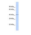 FKTN / Fukutin Antibody - Western blot of Human Fetal Brain. FKTN antibody dilution 1.0 ug/ml.  This image was taken for the unconjugated form of this product. Other forms have not been tested.