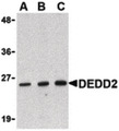 FLAME-3 / DEDD2 Antibody - Western blot of DEDD2 in RAW264.7 cell lysate with DEDD2 antibody at (A) 0.5, (B) 1 and (C) 2 ug/ml.