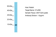 FLJ21075 Antibody -  This image was taken for the unconjugated form of this product. Other forms have not been tested.